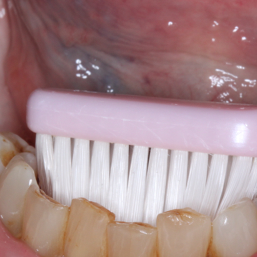 En traditionel tandbørste.